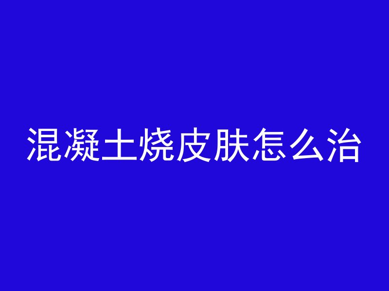 混凝土烧皮肤怎么治